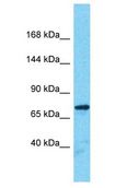 SORBS2 / ARGBP2 Antibody - SORBS2 / ARGBP2 antibody Western Blot of Fetal Kidney. Antibody dilution: 1 ug/ml.  This image was taken for the unconjugated form of this product. Other forms have not been tested.