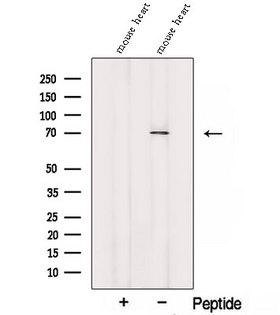SORBS2 / ARGBP2 Antibody - Western blot analysis of extracts of HepG2 cells using SORBS2 antibody. The lane on the left was treated with blocking peptide.