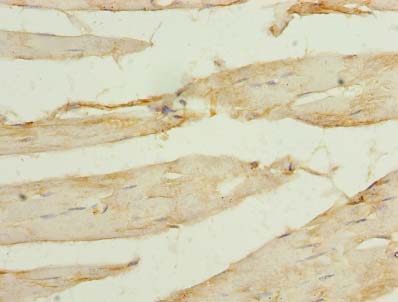 SORBS3 / Vinexin Antibody - Immunohistochemistry of paraffin-embedded human Skeletal muscle tissue using antibody at dilution of 1:100.