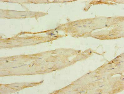 SORBS3 / Vinexin Antibody - Immunohistochemistry of paraffin-embedded human skeletal muscle tissue using SORBS3 Antibody at dilution of 1:100