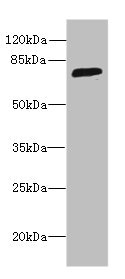 SORBS3 / Vinexin Antibody - Western blot All lanes: SORBS3 antibody at 8µg/ml + HepG2 whole cell lysate Secondary Goat polyclonal to rabbit IgG at 1/10000 dilution Predicted band size: 76, 37 kDa Observed band size: 76 kDa