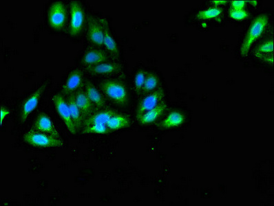 SORCS2 Antibody - Immunofluorescent analysis of HepG2 cells using SORCS2 Antibody at dilution of 1:100 and Alexa Fluor 488-congugated AffiniPure Goat Anti-Rabbit IgG(H+L)