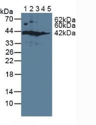 SORD / Sorbitol Dehydrogenase Antibody - Western Blot; Sample: Lane1: Rat Serum; Lane2: Rat Liver Tissue; Lane3: Rat Kidney Tissue; Lane4: Rat Prostate Tissue; Lane5: Human Hela Cells.