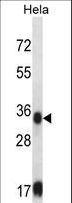 SORD / Sorbitol Dehydrogenase Antibody - SORD Antibody western blot of HeLa cell line lysates (35 ug/lane). The SORD antibody detected the SORD protein (arrow).