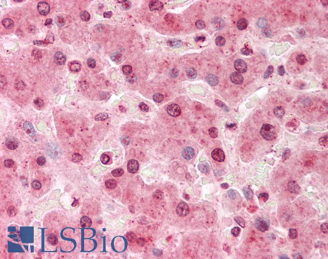 SORD / Sorbitol Dehydrogenase Antibody - Human Liver: Formalin-Fixed, Paraffin-Embedded (FFPE).  This image was taken for the unconjugated form of this product. Other forms have not been tested.