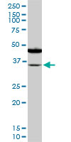 SORD / Sorbitol Dehydrogenase Antibody - SORD monoclonal antibody (M01), clone 4D3. Western blot of SORD expression in PC-12.
