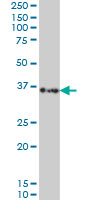 SORD / Sorbitol Dehydrogenase Antibody - SORD monoclonal antibody (M01), clone 4D3 Western blot of SORD expression in HeLa NE.