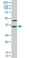 SORD / Sorbitol Dehydrogenase Antibody - SORD monoclonal antibody (M01), clone 4D3. Western blot of SORD expression in Raw 264.7.
