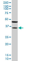 SORD / Sorbitol Dehydrogenase Antibody - SORD monoclonal antibody (M01), clone 4D3. Western blot of SORD expression in NIH/3T3.