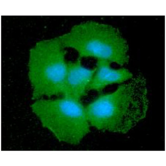 SORD / Sorbitol Dehydrogenase Antibody - ICC/IF analysis of SORD in Hep3B cells line, stained with DAPI (Blue) for nucleus staining and monoclonal anti-human SORD antibody (1:100) with goat anti-mouse IgG-Alexa fluor 488 conjugate (Green).