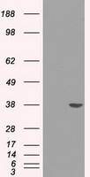 SORD / Sorbitol Dehydrogenase Antibody - HEK293T cells were transfected with the pCMV6-ENTRY control (Left lane) or pCMV6-ENTRY SORD (Right lane) cDNA for 48 hrs and lysed. Equivalent amounts of cell lysates (5 ug per lane) were separated by SDS-PAGE and immunoblotted with anti-SORD.