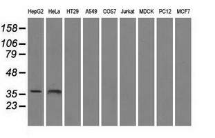 SORD / Sorbitol Dehydrogenase Antibody - Western blot of extracts (35 ug) from 9 different cell lines by using anti-SORD monoclonal antibody.