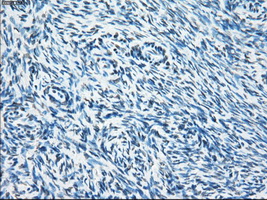 SORD / Sorbitol Dehydrogenase Antibody - IHC of paraffin-embedded Ovary tissue using anti-SORD mouse monoclonal antibody. (Dilution 1:50).