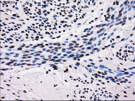 SORD / Sorbitol Dehydrogenase Antibody - IHC of paraffin-embedded endometrium tissue using anti-SORD mouse monoclonal antibody. (Dilution 1:50).