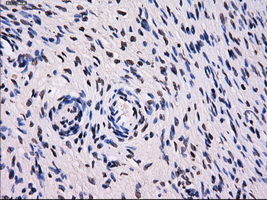 SORD / Sorbitol Dehydrogenase Antibody - IHC of paraffin-embedded Ovary tissue using anti-SORD mouse monoclonal antibody. (Dilution 1:50).