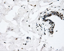 SORD / Sorbitol Dehydrogenase Antibody - IHC of paraffin-embedded breast tissue using anti-SORD mouse monoclonal antibody. (Dilution 1:50).