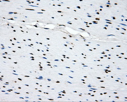 SORD / Sorbitol Dehydrogenase Antibody - IHC of paraffin-embedded colon tissue using anti-SORD mouse monoclonal antibody. (Dilution 1:50).