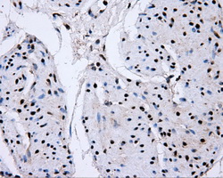 SORD / Sorbitol Dehydrogenase Antibody - IHC of paraffin-embedded bladder tissue using anti-SORD mouse monoclonal antibody. (Dilution 1:50).