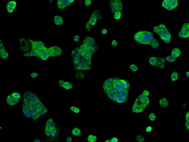 SORD / Sorbitol Dehydrogenase Antibody - Immunofluorescent staining of HepG2 cells using anti-SORD mouse monoclonal antibody.