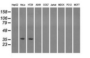 SORD / Sorbitol Dehydrogenase Antibody - Western blot analysis of extracts (35ug) from 9 different cell lines by using anti-SORD monoclonal antibody.