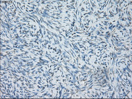 SORD / Sorbitol Dehydrogenase Antibody - Immunohistochemical staining of paraffin-embedded Ovary tissue using anti-SORD mouse monoclonal antibody. (Dilution 1:50).