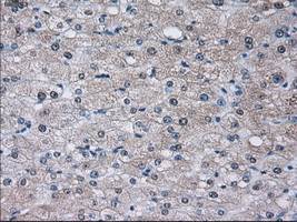 SORD / Sorbitol Dehydrogenase Antibody - IHC of paraffin-embedded liver tissue using anti-SORD mouse monoclonal antibody. (Dilution 1:50).
