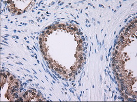 SORD / Sorbitol Dehydrogenase Antibody - IHC of paraffin-embedded prostate tissue using anti-SORD mouse monoclonal antibody. (Dilution 1:50).