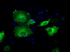 SORD / Sorbitol Dehydrogenase Antibody - Anti-SORD mouse monoclonal antibody  immunofluorescent staining of COS7 cells transiently transfected by pCMV6-ENTRY SORD.