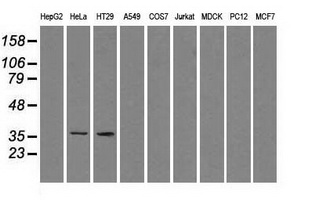 SORD / Sorbitol Dehydrogenase Antibody - Western blot of extracts (35 ug) from 9 different cell lines by using anti-SORD monoclonal antibody.