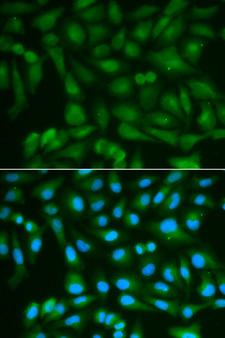 SORD / Sorbitol Dehydrogenase Antibody - Immunofluorescence analysis of MCF7 cells.