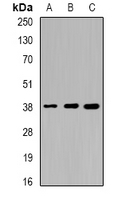 SORD / Sorbitol Dehydrogenase Antibody - Western blot analysis of Sorbitol Dehydrogenase expression in HT29 (A); mouse liver (B); mouse kidney (C) whole cell lysates.