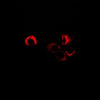 SORD / Sorbitol Dehydrogenase Antibody - Immunofluorescent analysis of Sorbitol Dehydrogenase staining in MCF7 cells. Formalin-fixed cells were permeabilized with 0.1% Triton X-100 in TBS for 5-10 minutes and blocked with 3% BSA-PBS for 30 minutes at room temperature. Cells were probed with the primary antibody in 3% BSA-PBS and incubated overnight at 4 deg C in a humidified chamber. Cells were washed with PBST and incubated with a DyLight 594-conjugated secondary antibody (red) in PBS at room temperature in the dark.