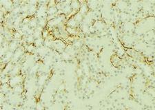 SORD / Sorbitol Dehydrogenase Antibody - 1:100 staining mouse kidney tissue by IHC-P. The sample was formaldehyde fixed and a heat mediated antigen retrieval step in citrate buffer was performed. The sample was then blocked and incubated with the antibody for 1.5 hours at 22°C. An HRP conjugated goat anti-rabbit antibody was used as the secondary.