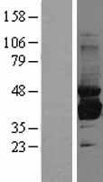 SORD / Sorbitol Dehydrogenase Protein - Western validation with an anti-DDK antibody * L: Control HEK293 lysate R: Over-expression lysate