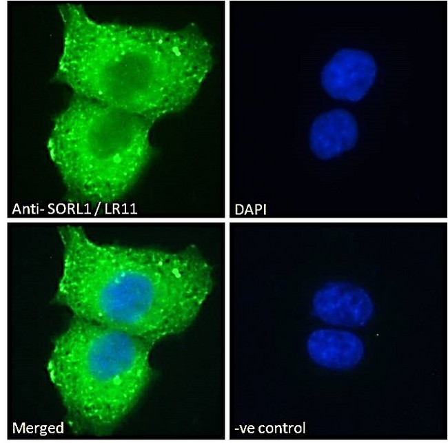 SORL1 Antibody - Goat Anti-SORL1 / LR11 (C Terminus) Antibody Immunofluorescence analysis of paraformaldehyde fixed A431 cells, permeabilized with 0.15% Triton. Primary incubation 1hr (10ug/ml) followed by Alexa Fluor 488 secondary antibody (2ug/ml), showing cytoplasmic with endosome staining. The nuclear stain is DAPI (blue). Negative control: Unimmunized goat IgG (10ug/ml) followed by Alexa Fluor 488 secondary antibody (2ug/ml).