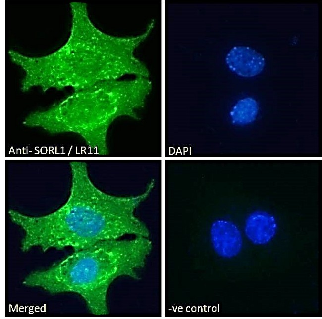 SORL1 Antibody - Goat Anti-SORL1 / LR11 (C Terminus) Antibody Immunofluorescence analysis of paraformaldehyde fixed HepG2 cells, permeabilized with 0.15% Triton. Primary incubation 1hr (10ug/ml) followed by Alexa Fluor 488 secondary antibody (2ug/ml), showing cytoplasmic/endosome, membrane and nuclear staining. The nuclear stain is DAPI (blue). Negative control: Unimmunized goat IgG (10ug/ml) followed by Alexa Fluor 488 secondary antibody (2ug/ml).