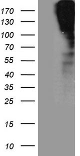 SORL1 Antibody - HEK293T cells were transfected with the pCMV6-ENTRY control. (Left lane) or pCMV6-ENTRY SORL1. (Right lane) cDNA for 48 hrs and lysed. Equivalent amounts of cell lysates. (5 ug per lane) were separated by SDS-PAGE and immunoblotted with anti-SORL1. (1:2000)