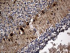 SORL1 Antibody - Immunohistochemical staining of paraffin-embedded Human embryonic cerebellum within the normal limits using anti-SORL1 mouse monoclonal antibody. (Heat-induced epitope retrieval by 1mM EDTA in 10mM Tris buffer. (pH8.5) at 120 oC for 3 min. (1:2000)