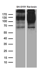 SORL1 Antibody - Western blot analysis of extracts. (35ug) from SH-SY5Y cell line and rat brain tissue lysate by using anti-SORL1 monoclonal antibody. (1:500)