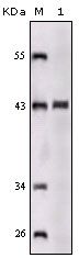 SORL1 Antibody - SORL1 Antibody in Western Blot (WB)