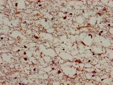 SORL1 Antibody - Immunohistochemistry image of paraffin-embedded human brain tissue at a dilution of 1:100