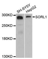 SORL1 Antibody - Western blot analysis of extracts of various cell lines, using SORL1 antibody at 1:3000 dilution. The secondary antibody used was an HRP Goat Anti-Rabbit IgG (H+L) at 1:10000 dilution. Lysates were loaded 25ug per lane and 3% nonfat dry milk in TBST was used for blocking. An ECL Kit was used for detection and the exposure time was 90s.