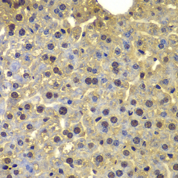 SORT1 / Sortilin Antibody - Immunohistochemistry of paraffin-embedded mouse liver using SORT1 antibody at dilution of 1:100 (40x lens).