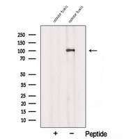 SORT1 / Sortilin Antibody - Western blot analysis of extracts of mouse brain tissue using Sortilin antibody. The lane on the left was treated with blocking peptide.