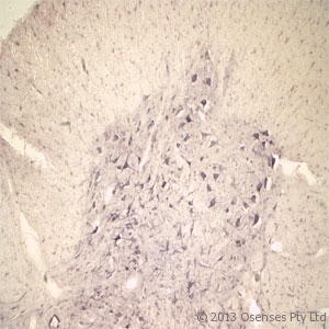 SORT1 / Sortilin Antibody - Rabbit antibody to Sortilin. IHC on rat spinal cord using Rabbit antibody to extracellular, N-terminal part of Sortilin (Neurotensin receptor 3, NTR3, Sort1): IgG at a concentration of 10 ug/ml. Pre-absorption of the antibody with the immunizing peptide completely abolishes the immunostaining (not shown).