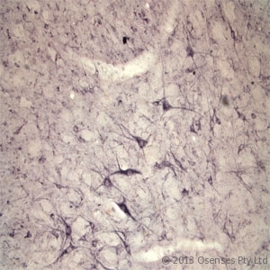 SORT1 / Sortilin Antibody - Rabbit antibody to Sortilin. IHC on rat spinal cord using Rabbit antibody to extracellular, N-terminal part of Sortilin (Neurotensin receptor 3, NTR3, Sort1): IgG at a concentration of 10 ug/ml. Pre-absorption of the antibody with the immunizing peptide completely abolishes the immunostaining (not shown).