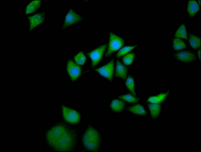 SOS1 Antibody - Immunofluorescence staining of Hela cells diluted at 1:133, counter-stained with DAPI. The cells were fixed in 4% formaldehyde, permeabilized using 0.2% Triton X-100 and blocked in 10% normal Goat Serum. The cells were then incubated with the antibody overnight at 4°C.The Secondary antibody was Alexa Fluor 488-congugated AffiniPure Goat Anti-Rabbit IgG (H+L).