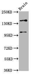 SOS1 Antibody - Western Blot Positive WB detected in: Rat brain tissue All Lanes: SOS1 antibody at 4.6µg/ml Secondary Goat polyclonal to rabbit IgG at 1/50000 dilution Predicted band size: 153, 37 KDa Observed band size: 153 KDa