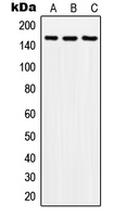 SOS2 Antibody - Western blot analysis of SOS2 expression in A549 (A); SP2/0 (B); H9C2 (C) whole cell lysates.