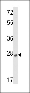 SOST / Sclerostin Antibody - Western blot of lysates from human kidney and liver tissue lysates (from left to right), using SOST Antibody. Antibody was diluted at 1:1000 at each lane. A goat anti-rabbit IgG H&L (HRP) at 1:5000 dilution was used as the secondary antibody. Lysates at 35ug per lane.